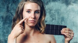 Akne (Sivilce) Nedir? Belirtileri ve Tedavi Yöntemleri Nelerdir?