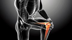 Kemik İliği Kanseri Nedir? Kemik İliği Kanseri Belirtileri ve Tedavisi Nelerdir?