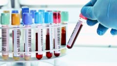 PDW (Trombosit Dağılım Genişliği) Nedir? Trombosit Neden Önemlidir?